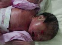 佛山地区有哪些私立的机构可以做试管技术？tsh高不一定会影响试管移植？