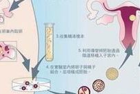 死精率80%的男性可以在沧州市做三代试管吗？公开2026做三代试管条件